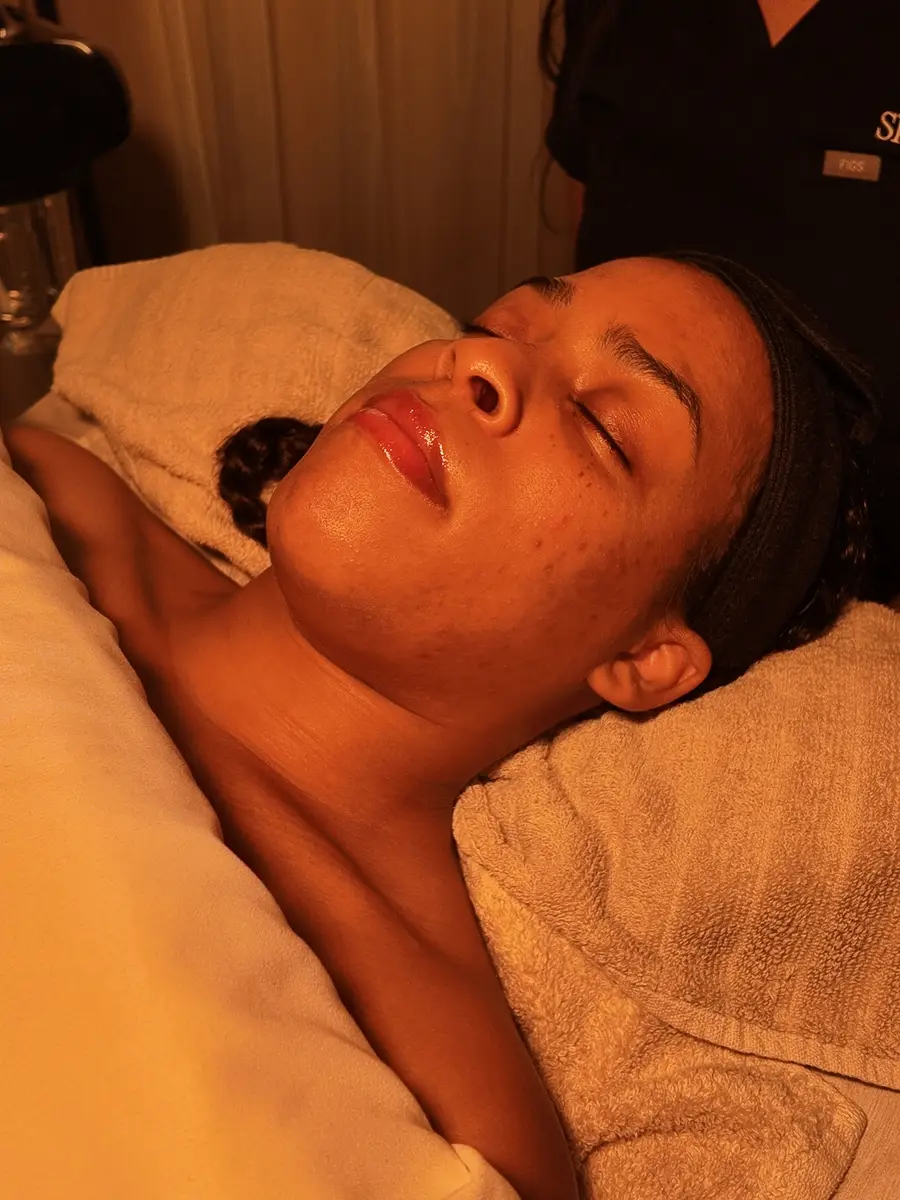 Close-up of a client's congested, breakout-prone skin before a facial at Skin Lab in Memphis