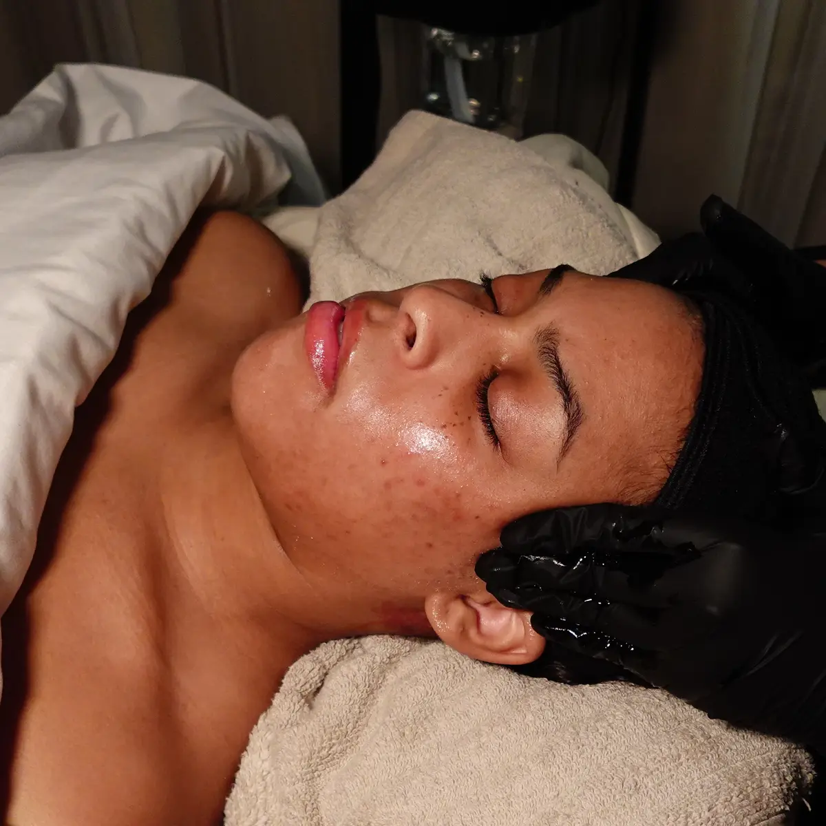Lymphatic massage technique being performed to reduce facial puffiness at Skin Lab in Memphis